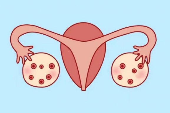 试管助孕过程中，卵泡发育不良怎么办？