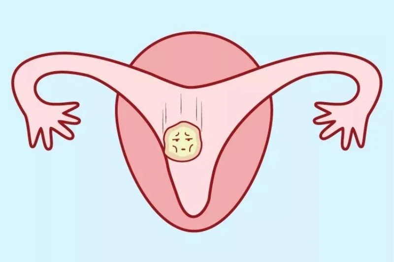 情绪不好，如何影响试管成功率？