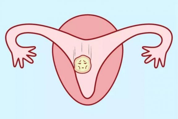 情绪不好，如何影响试管成功率？